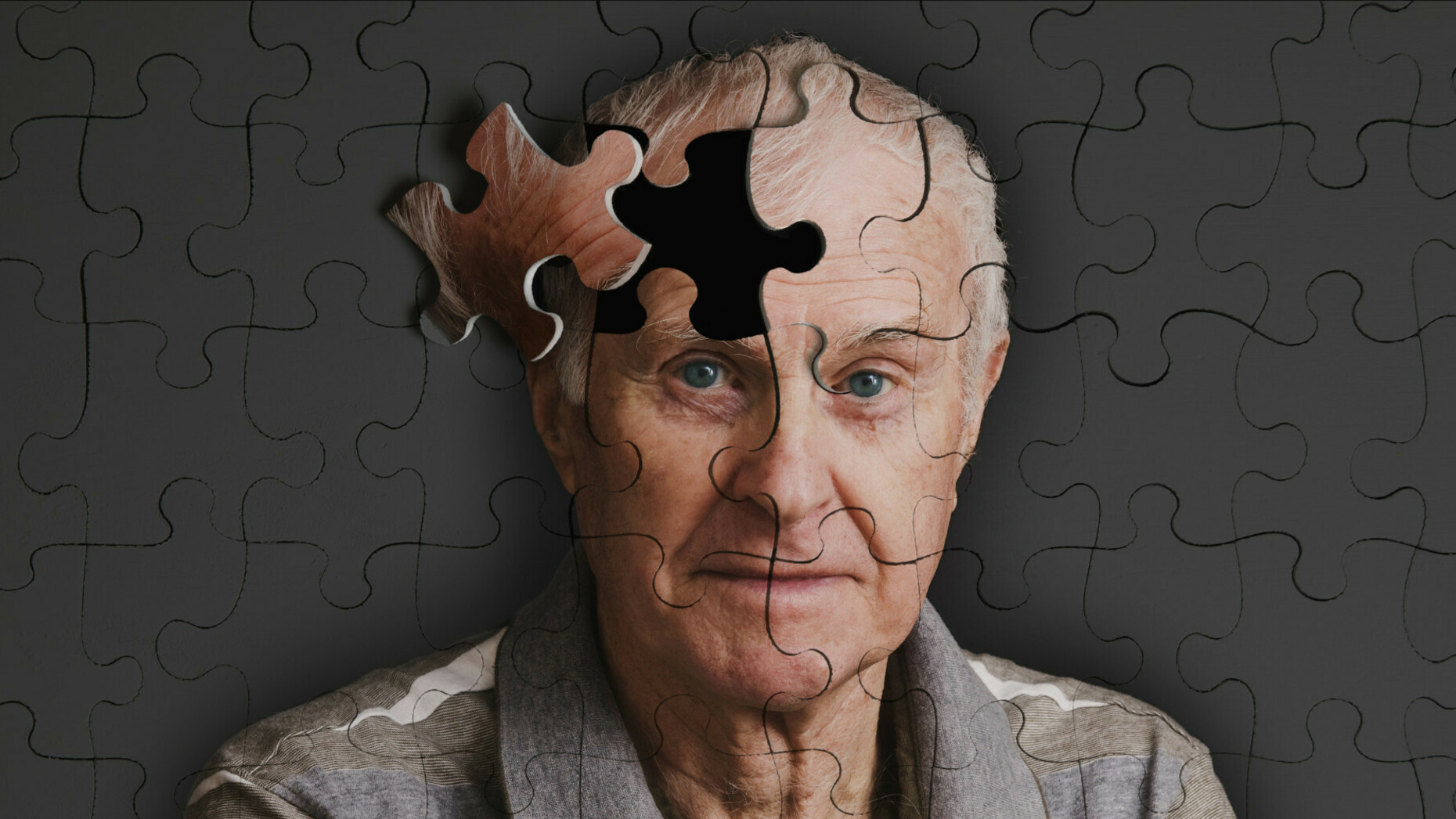 Avanza el conocimiento de una variante que protege del alzhéimer hereditario temprano