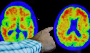 Identifican un área del cerebro que responde a las amenazas, según un estudio