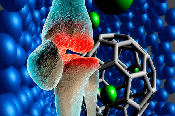 Crean un biomaterial capaz de regenerar cartílago dañado en las articulaciones