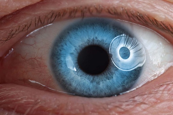 Una prótesis ocular permite leer a personas con ceguera irreversible