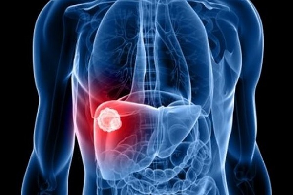 Descubren una nueva proteína para luchar con el cáncer de hígado