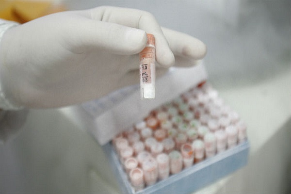 Una nueva prueba para detectar el VIH es desarrollada por científicos en Estados Unidos